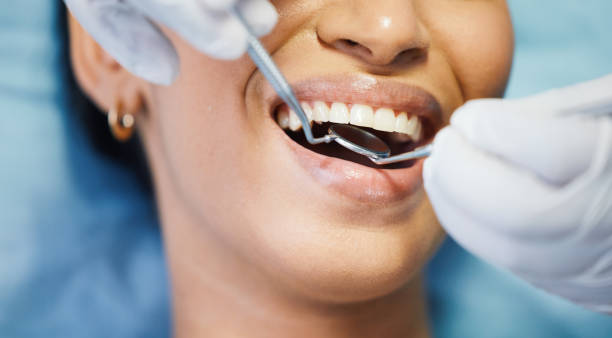 Best Emergency Cosmetic Dentistry in Galveston, IN