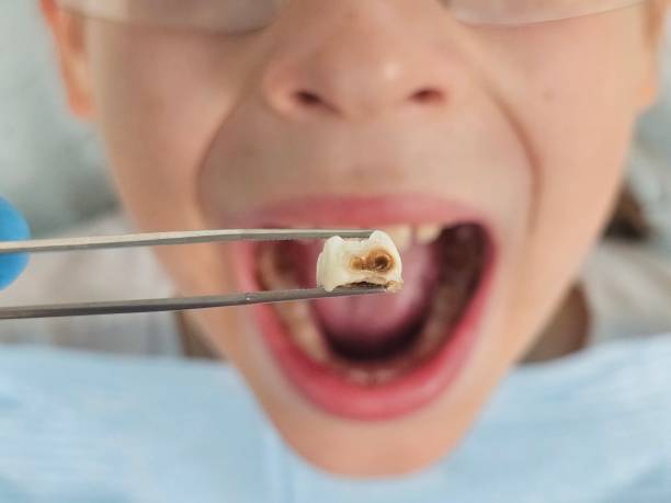 Best Orthodontic Emergency Dentist in Galveston, IN